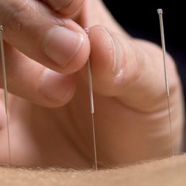 Acupuncture Activates Natural Opioids