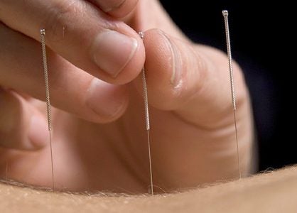 Acupuncture Activates Natural Opioids