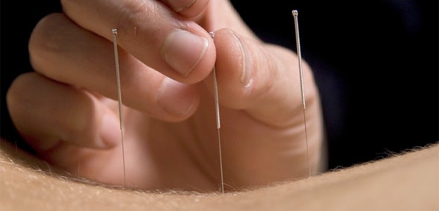 Acupuncture Activates Natural Opioids